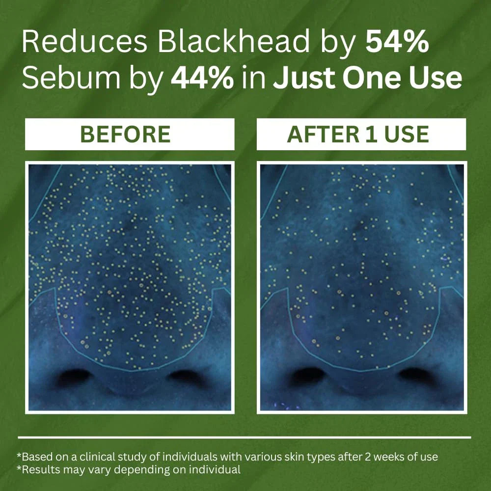 P.CALM Holy Basil Bubble Deep Mask – Holy Basil & Carbonated Water for Cleansing