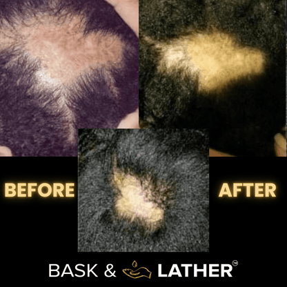 Scalp Stimulator | Hair Growth Oil-Shop